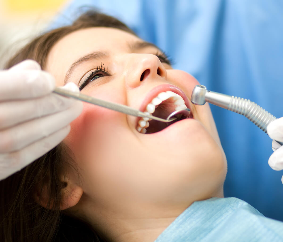 How Safe Are Dental Implants?