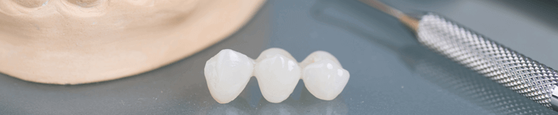 Dental Crowns Skowhegan ME - Dental Crowns & Bridges