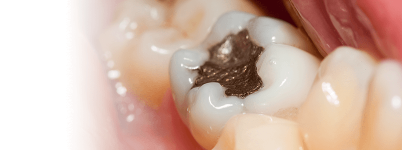 Biologic Dental Skowhegan ME - Biologic Dentistry